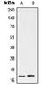 Ubiquitin Conjugating Enzyme E2 A antibody, orb214710, Biorbyt, Western Blot image 