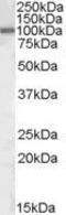 Zinc Finger E-Box Binding Homeobox 1 antibody, GTX88467, GeneTex, Western Blot image 