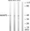 A-Kinase Anchoring Protein 5 antibody, PA5-38594, Invitrogen Antibodies, Western Blot image 