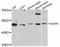 Glycine Receptor Alpha 1 antibody, STJ23802, St John