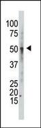 Glucosaminyl (N-Acetyl) Transferase 1 antibody, PA5-12146, Invitrogen Antibodies, Western Blot image 