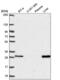 Methenyltetrahydrofolate Synthetase antibody, NBP2-58656, Novus Biologicals, Western Blot image 