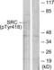 SRC Proto-Oncogene, Non-Receptor Tyrosine Kinase antibody, LS-C117477, Lifespan Biosciences, Western Blot image 