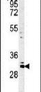 Chromosome 2 Open Reading Frame 49 antibody, PA5-25113, Invitrogen Antibodies, Western Blot image 