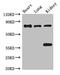 BR serine/threonine-protein kinase 1 antibody, CSB-PA837438LA01HU, Cusabio, Western Blot image 