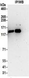 Kinesin Family Member 5A antibody, NBP2-32231, Novus Biologicals, Immunoprecipitation image 