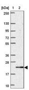 Katanin Regulatory Subunit B1 Like 1 antibody, NBP2-31859, Novus Biologicals, Western Blot image 