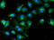 Tubulin Alpha Like 3 antibody, LS-C173508, Lifespan Biosciences, Immunofluorescence image 