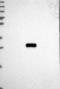 Solute Carrier Family 66 Member 2 antibody, NBP2-13806, Novus Biologicals, Western Blot image 