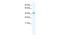 Potassium Channel Tetramerization Domain Containing 13 antibody, A10472, Boster Biological Technology, Western Blot image 