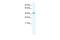 Potassium Channel Tetramerization Domain Containing 13 antibody, A10472, Boster Biological Technology, Western Blot image 