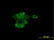 Retinoic Acid Receptor Alpha antibody, LS-B5524, Lifespan Biosciences, Immunofluorescence image 
