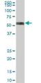 Insulin Like Growth Factor 2 MRNA Binding Protein 2 antibody, H00010644-B01P, Novus Biologicals, Western Blot image 