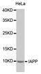 Islet Amyloid Polypeptide antibody, STJ24112, St John