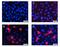 Fms Related Tyrosine Kinase 4 antibody, NBP1-18651, Novus Biologicals, Immunocytochemistry image 