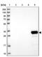 Glycine-N-Acyltransferase Like 1 antibody, NBP2-48708, Novus Biologicals, Western Blot image 