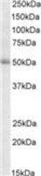 Thyroid Hormone Receptor Interactor 6 antibody, LS-C112957, Lifespan Biosciences, Western Blot image 