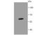 Keratin 5 antibody, NBP2-67027, Novus Biologicals, Western Blot image 