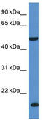Inositol Polyphosphate-5-Phosphatase K antibody, TA343120, Origene, Western Blot image 