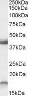 Receptor Activity Modifying Protein 1 antibody, PA5-18958, Invitrogen Antibodies, Western Blot image 