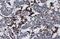 Major Histocompatibility Complex, Class II, DR Alpha antibody, GTX113732, GeneTex, Immunohistochemistry paraffin image 
