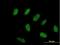 Zinc Finger Protein 776 antibody, H00284309-B01P, Novus Biologicals, Immunocytochemistry image 