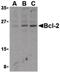 BCL2 antibody, PA5-20068, Invitrogen Antibodies, Western Blot image 