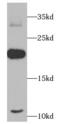 Tumor Necrosis Factor antibody, FNab09822, FineTest, Western Blot image 