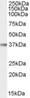 Interleukin 12B antibody, EB07862, Everest Biotech, Western Blot image 