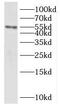 KH domain-containing, RNA-binding, signal transduction-associated protein 3 antibody, FNab04523, FineTest, Western Blot image 