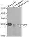 Lymphocyte Antigen 96 antibody, LS-B14871, Lifespan Biosciences, Western Blot image 