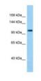 Tudor Domain Containing 7 antibody, NBP1-98585, Novus Biologicals, Western Blot image 
