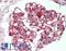 Interleukin 17 Receptor B antibody, LS-B15801, Lifespan Biosciences, Immunohistochemistry paraffin image 