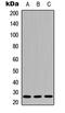 Interleukin-26 antibody, LS-C368598, Lifespan Biosciences, Western Blot image 