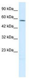 Tryptophan Hydroxylase 2 antibody, TA334766, Origene, Western Blot image 