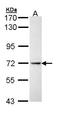Interleukin 1 Receptor Type 1 antibody, LS-C109445, Lifespan Biosciences, Western Blot image 