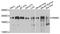 Polybromo 1 antibody, STJ111920, St John