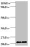 Fragile Histidine Triad Diadenosine Triphosphatase antibody, A57805-100, Epigentek, Western Blot image 