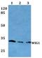 Zinc Finger Matrin-Type 3 antibody, GTX66858, GeneTex, Western Blot image 
