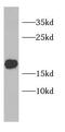 Plasminogen Receptor With A C-Terminal Lysine antibody, FNab01145, FineTest, Western Blot image 