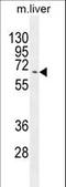 Kyphoscoliosis Peptidase antibody, LS-C165657, Lifespan Biosciences, Western Blot image 