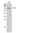 CLPTM1 Regulator Of GABA Type A Receptor Forward Trafficking antibody, A08423, Boster Biological Technology, Western Blot image 