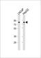 KH-Type Splicing Regulatory Protein antibody, 62-510, ProSci, Western Blot image 