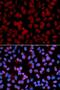 TNF Alpha Induced Protein 3 antibody, LS-C331915, Lifespan Biosciences, Immunofluorescence image 