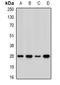 Acidic Nuclear Phosphoprotein 32 Family Member A antibody, orb340968, Biorbyt, Western Blot image 
