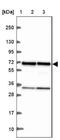 Eukaryotic Translation Initiation Factor 3 Subunit D antibody, NBP2-39069, Novus Biologicals, Western Blot image 