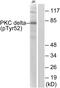 Protein Kinase C Delta antibody, PA5-38417, Invitrogen Antibodies, Western Blot image 