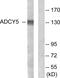 Adenylate Cyclase 5 antibody, PA5-38843, Invitrogen Antibodies, Western Blot image 