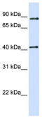 Thioredoxin Related Transmembrane Protein 4 antibody, TA338458, Origene, Western Blot image 