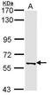 Peptidyl Arginine Deiminase 4 antibody, PA5-29880, Invitrogen Antibodies, Western Blot image 